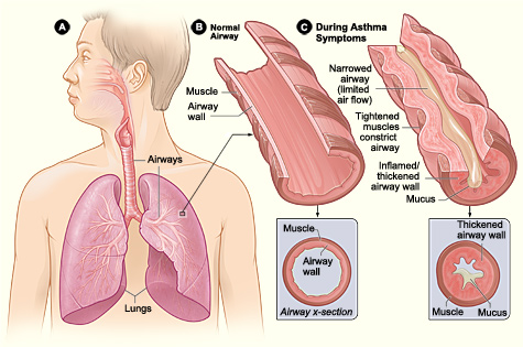Fisiopatologia da asma bronquica
